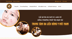 Desktop Screenshot of chuatrimuntrungca.com